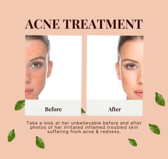 2% Salicylic Acid Foaming Facewash